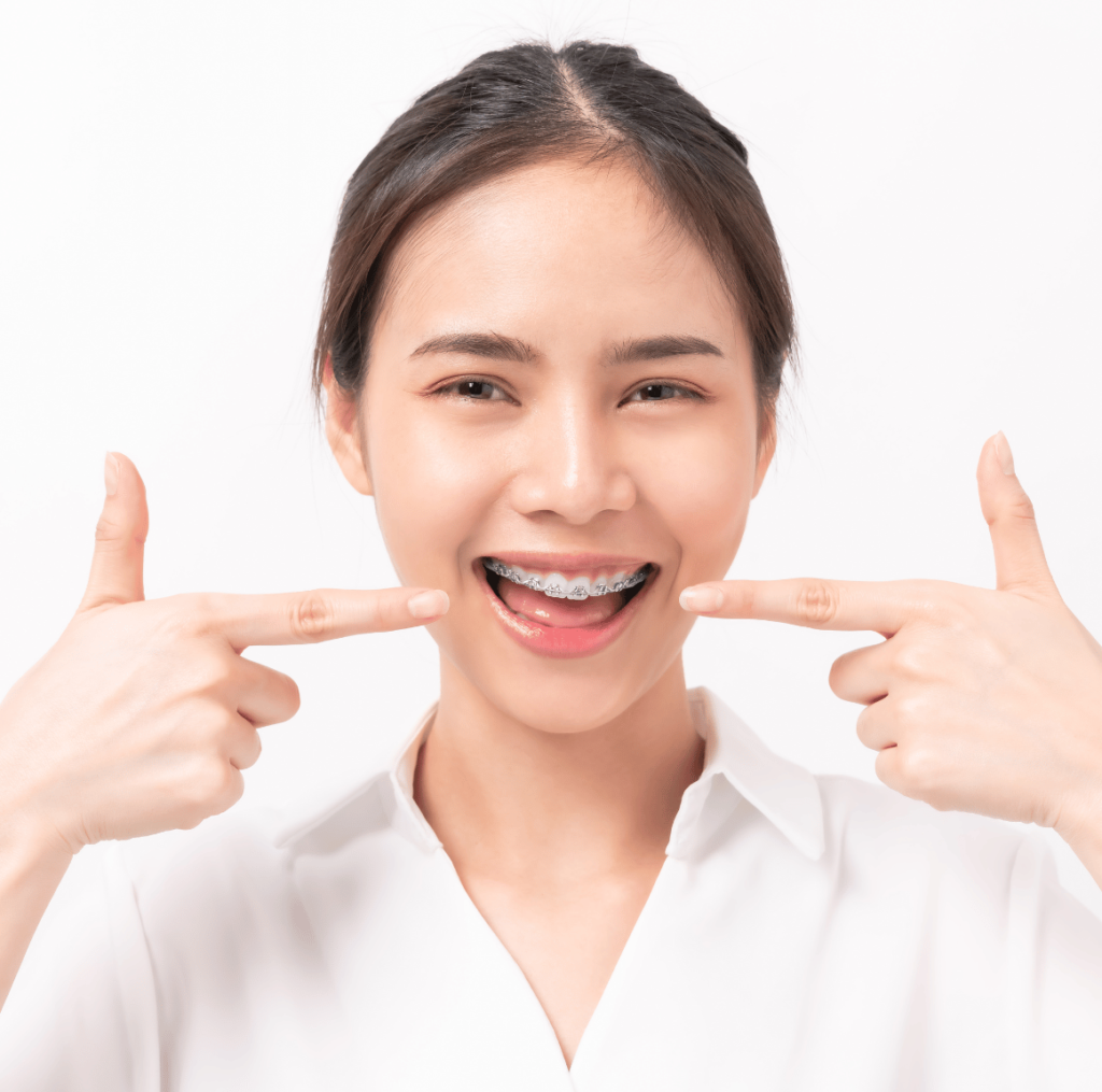 Woman Smiling with Braces On - Dr Amanda Koh