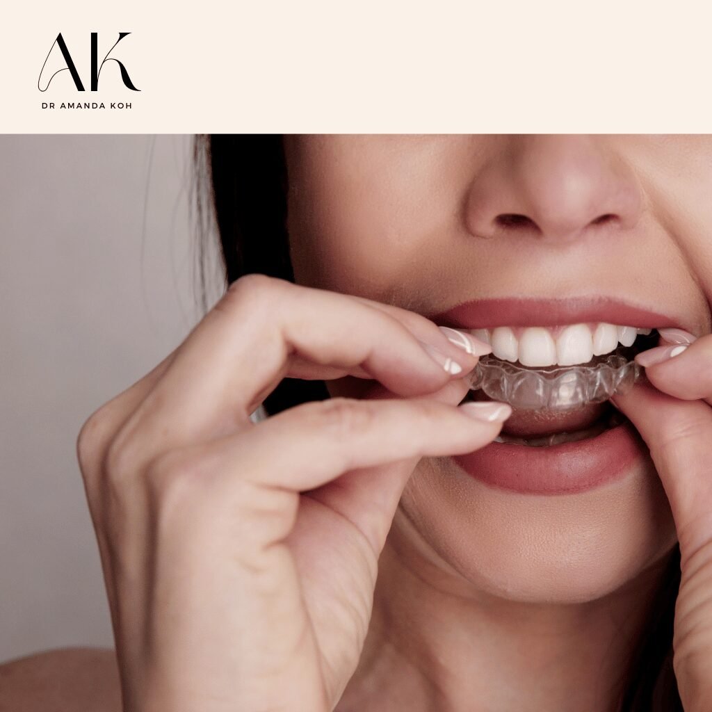 Woman Wearing Angel Aligner - Dr Amanda Koh