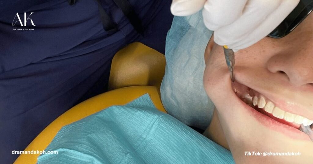 Placement of Attachments for Angel Aligners - Dr Amanda Koh